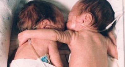image: Denne klemmen i 1995 reddet et liv, og førte til store endringer